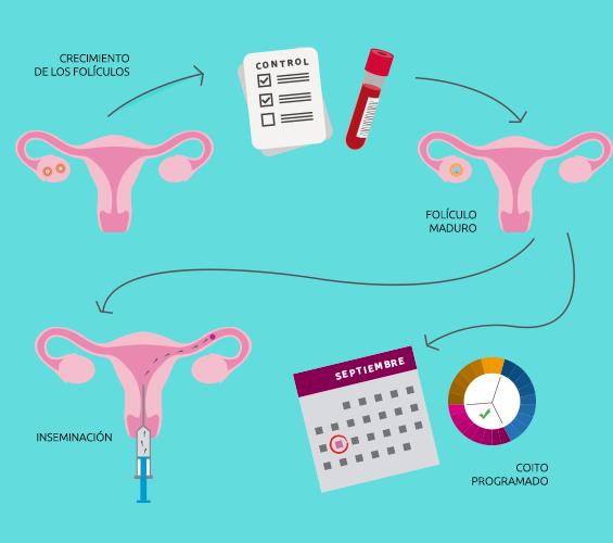 https://www.fertilt.com/wp-content/uploads/2015/11/proceso-induccion-a-la-ovulacion.png