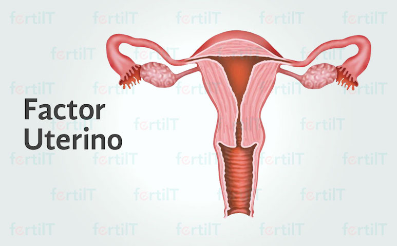 factor uterino