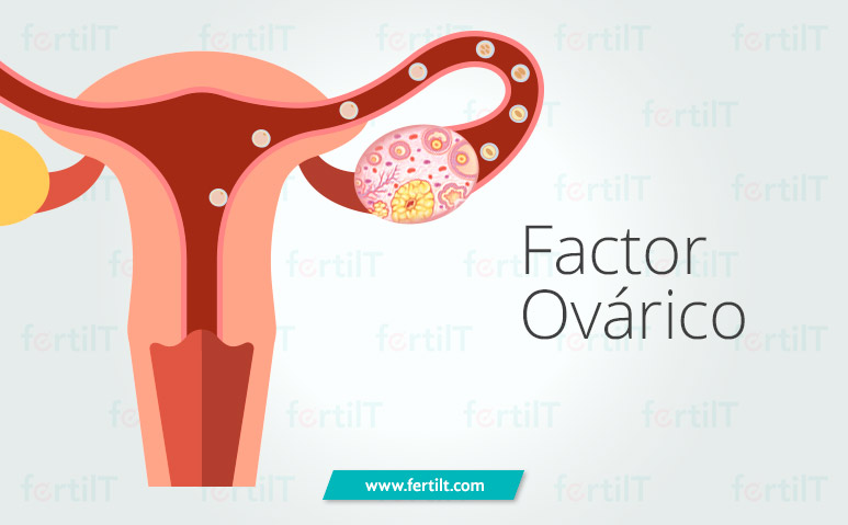 Representación de infertilidad por factor ovárico