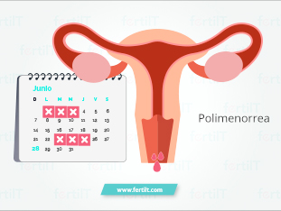 polimenorrea-que-es.jpg