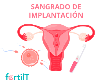 Imagen destacada de sangrado de implantación