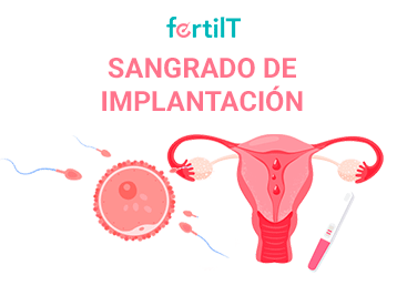 Portada de artículo Sangrado de implantación