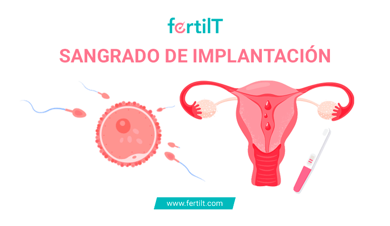 Portada de artículo Sangrado de implantación: qué es, síntomas y cuánto dura