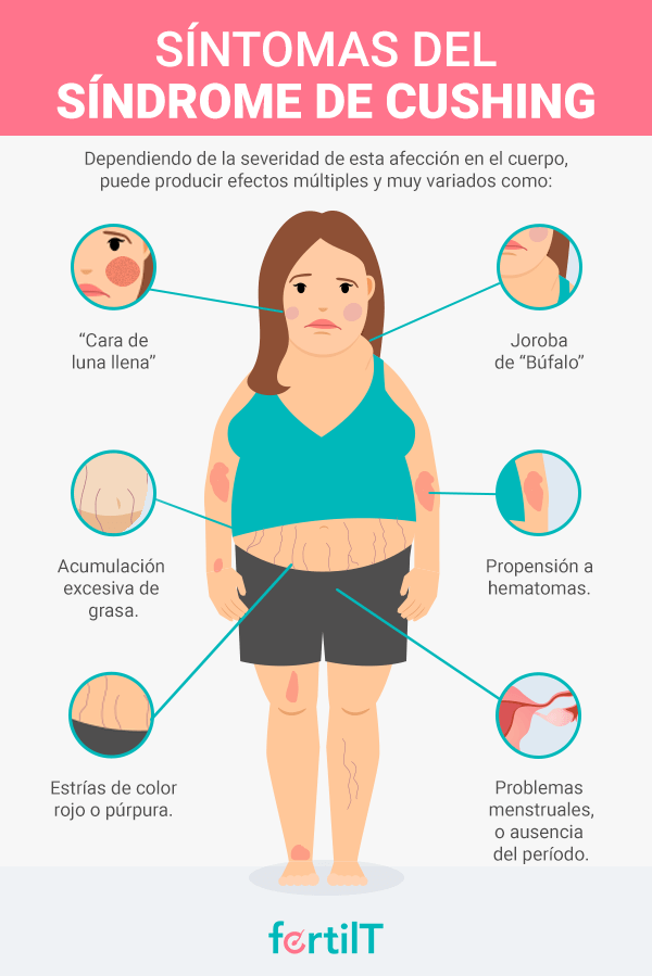 infografia sintomas del síndrome de cushing