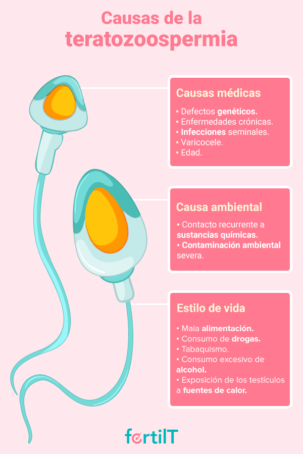 infografia casusas de la teratozoospermia