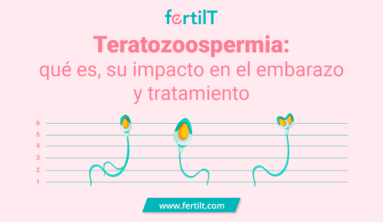 dibujo de espermatozoides con problemas por teratozoospermia