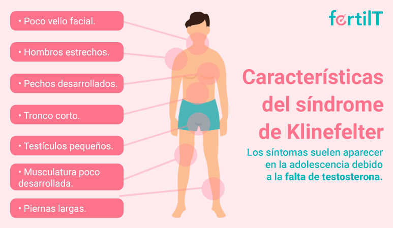 Infografía Características del Síndrome de Klinefelter 