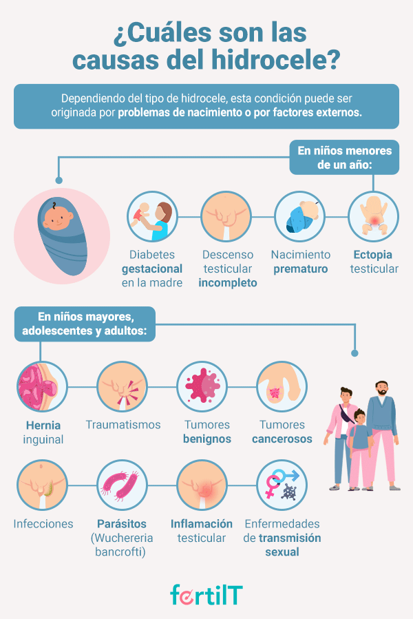 Infografía sobre las causas del Hidrocele