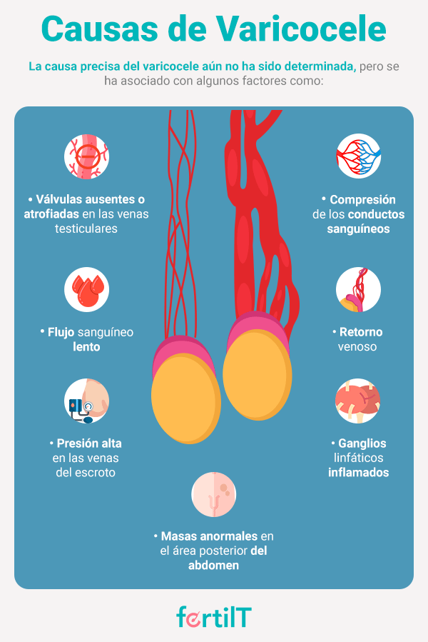 Infografía Causas de Varicocele