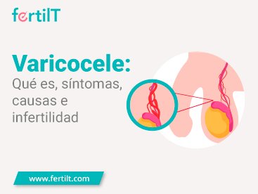 Portada mini del artículo Varicocele: Qué es, síntomas, causas e infertilidad