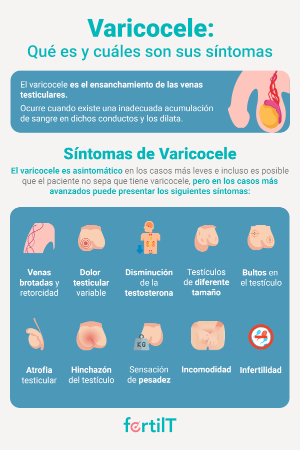 Infografía con definición de varicocele y sus síntomas 
