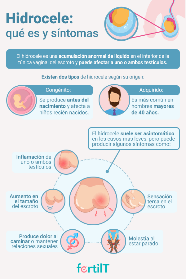 Infografía con definición del Hidrocele y sus síntomas
