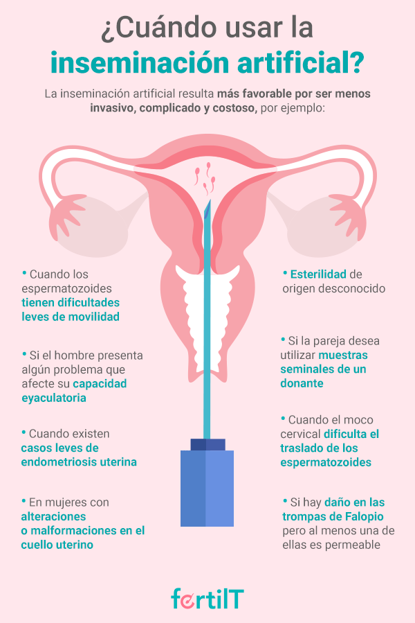 Infografía sobre cuando usar la inseminación artificial