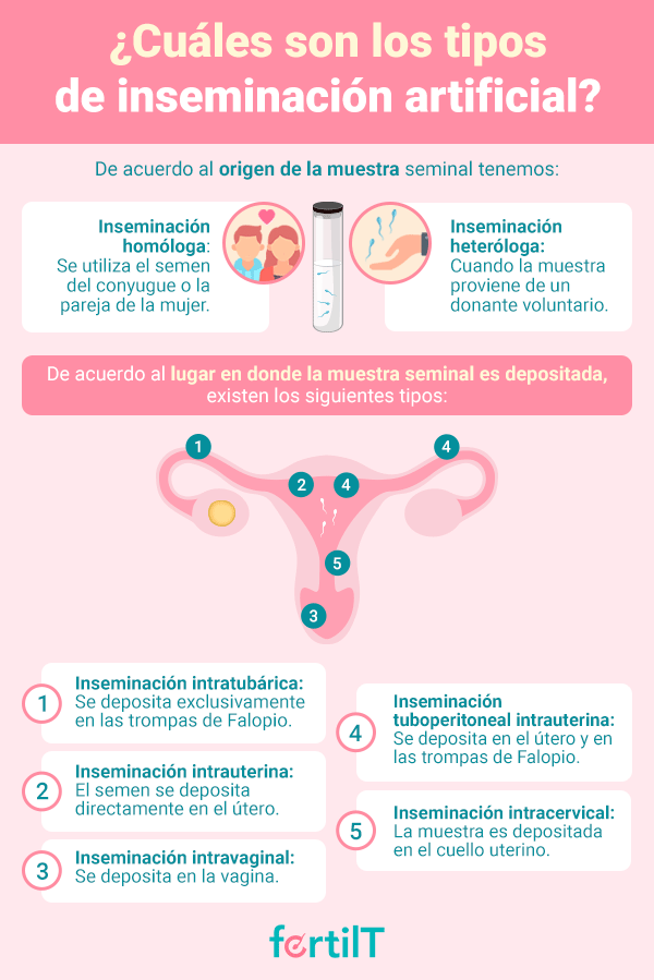 Infografía tipos de inseminación artificial