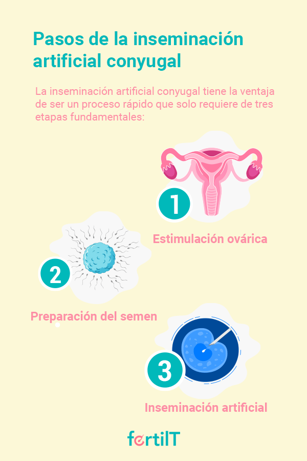 Infografía con los pasas para realizar una inseminación artificial conyugal