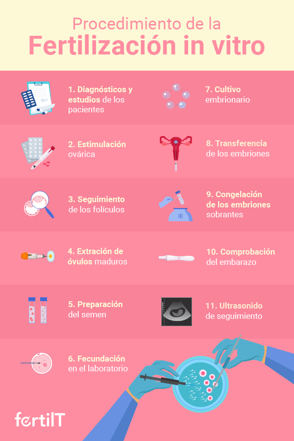 Infografía del procedimiento de la fertilización in vitro