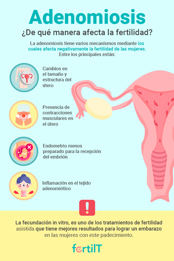 Infografía que explica cómo la adenomiosis afecta la fertilidad