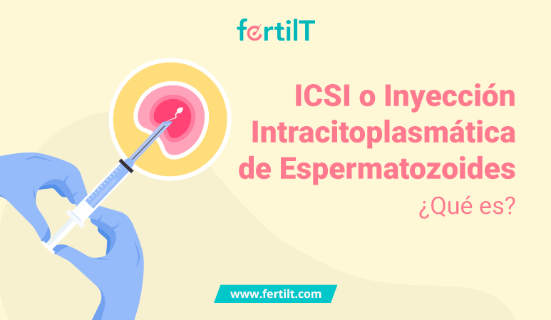 Portada para artículo ICSI o inyección intracitoplasmática de espermatozoides