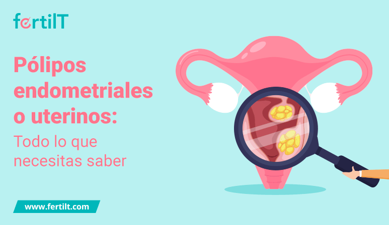 Portada del artículo Pólipos endometriales o uterinos todo lo que necesitas saber