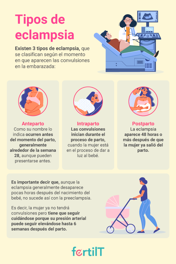 Infografía con los tipos de eclampsia