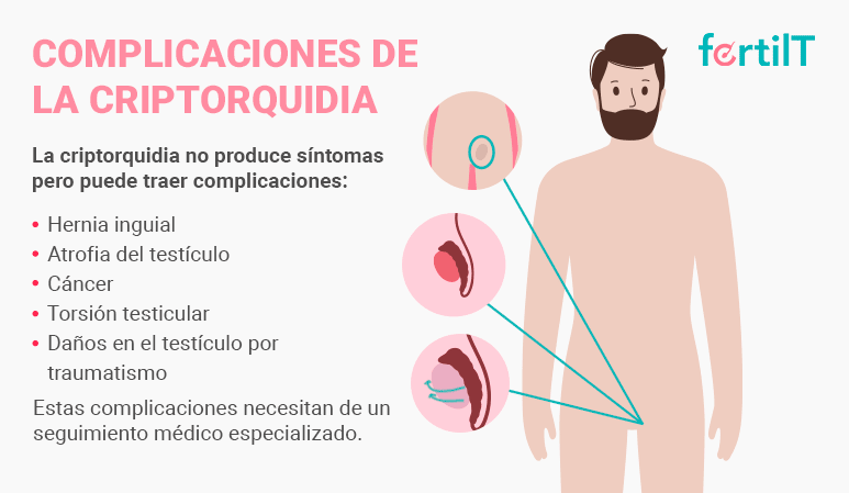 Infografía con las complicaciones de la criptorquidia