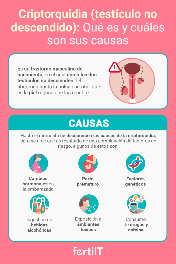 Infografía con la definición y las causas de la criptorquidia