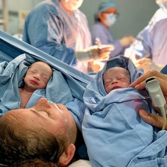 Atendiendo parto de gemelos en Clínica de fertilidad