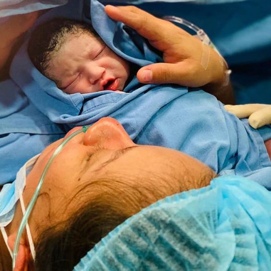 Entregando bebe recién nacido después del parto.