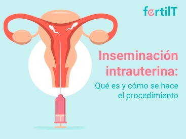 inseminacion-intrauterina-miniatura.webp