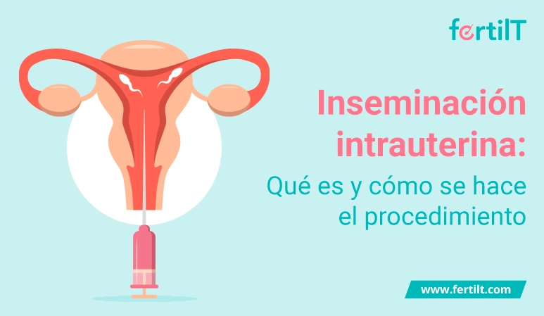 Portada del artículo Inseminación Intrauterina: Qué es y cómo se hace el procedimiento