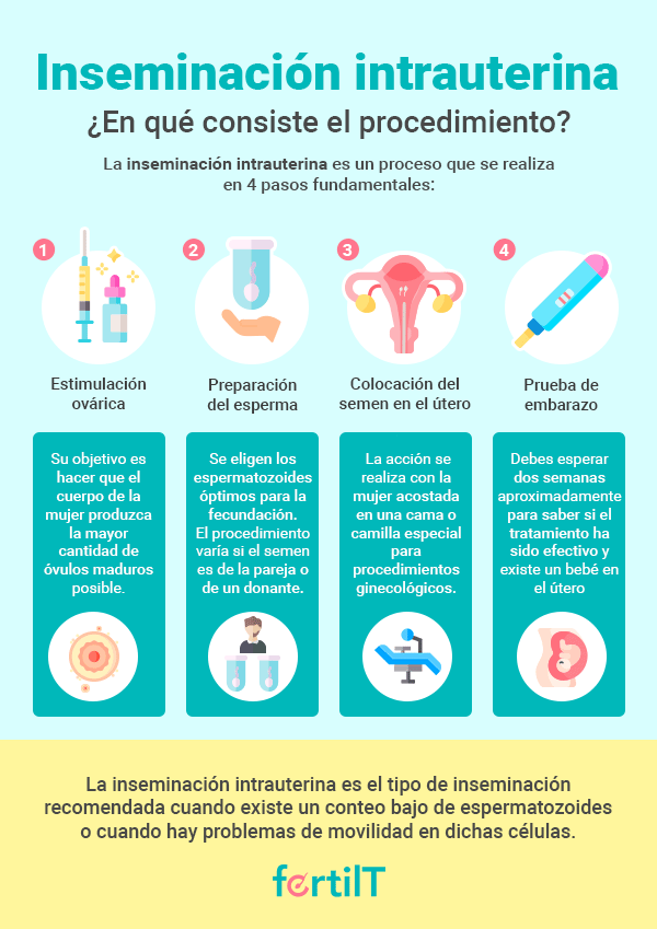 Pasos de la inseminación intrauterina en infografía verde 
