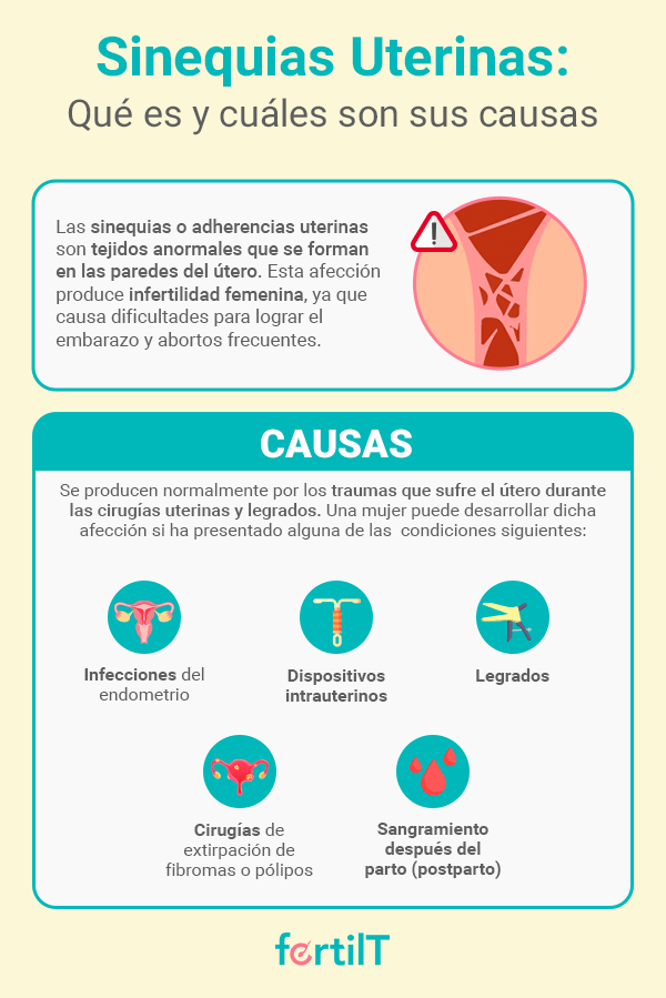 Infografía con causas de la Sinequia Uterina