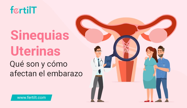 Portada de blog Sinequias Uterinas: Qué son y cómo afectan el embarazo 