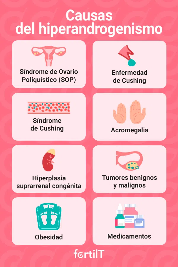 Causas del hiperandrogenismo en infografía rosada