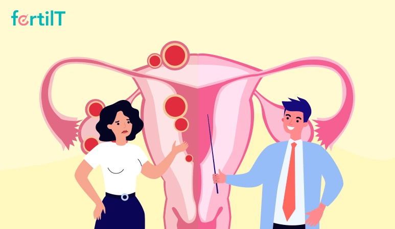 Cirugía correctiva para endometriosis