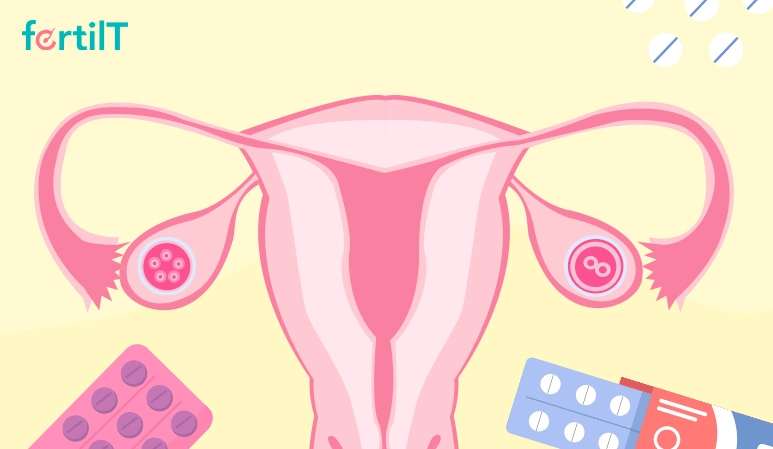 Medicamentos para inducir la ovulación