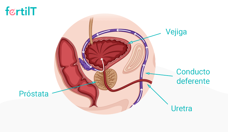 Problemas de eyaculación retrógrada