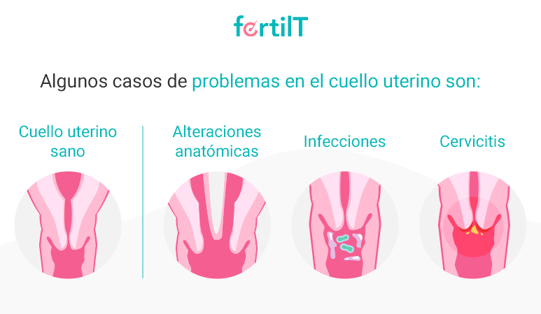 Distintos problemas en el cuello del útero
