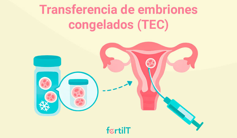 Técnica de reproducción asistida para ser madre sin pareja